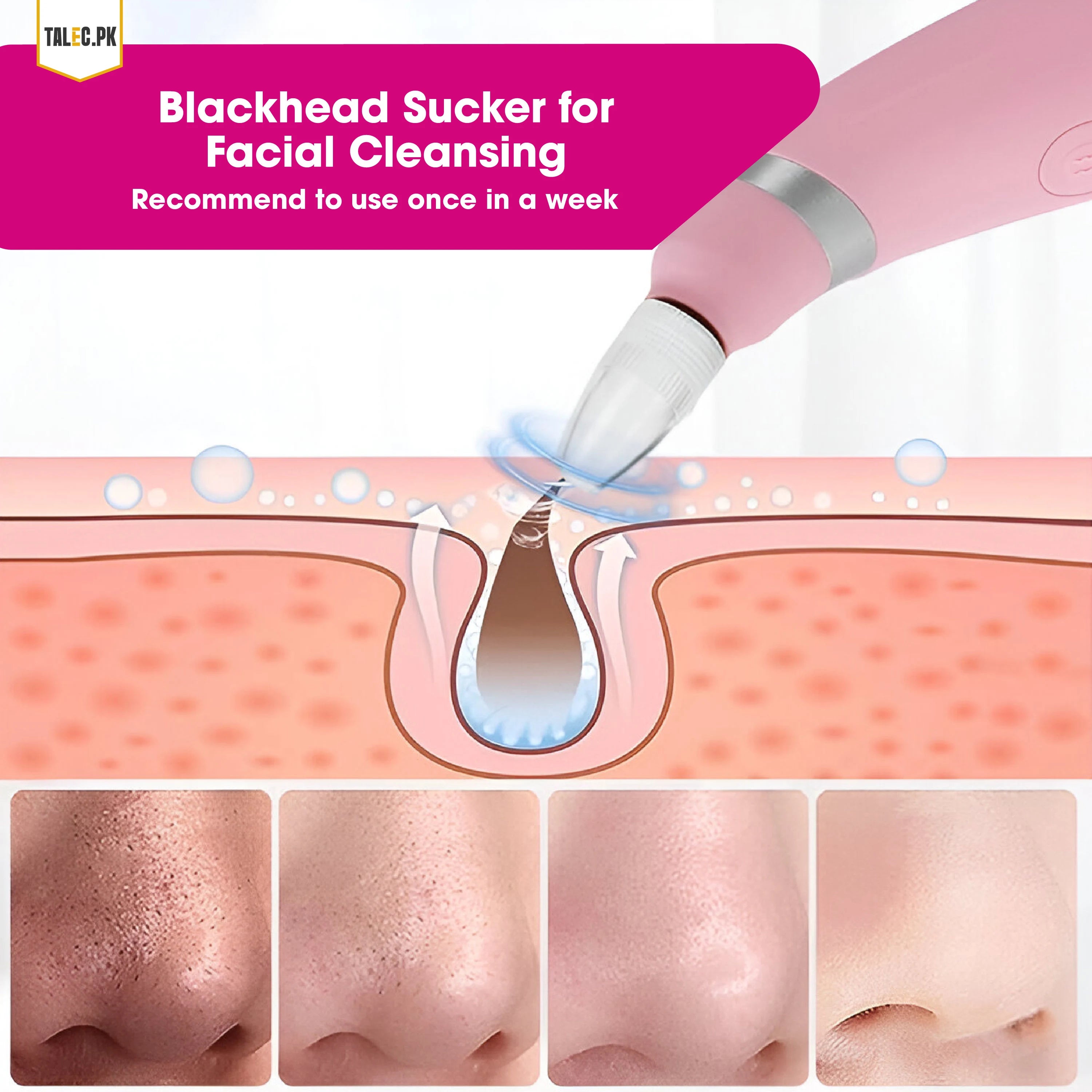 Black Head Remover