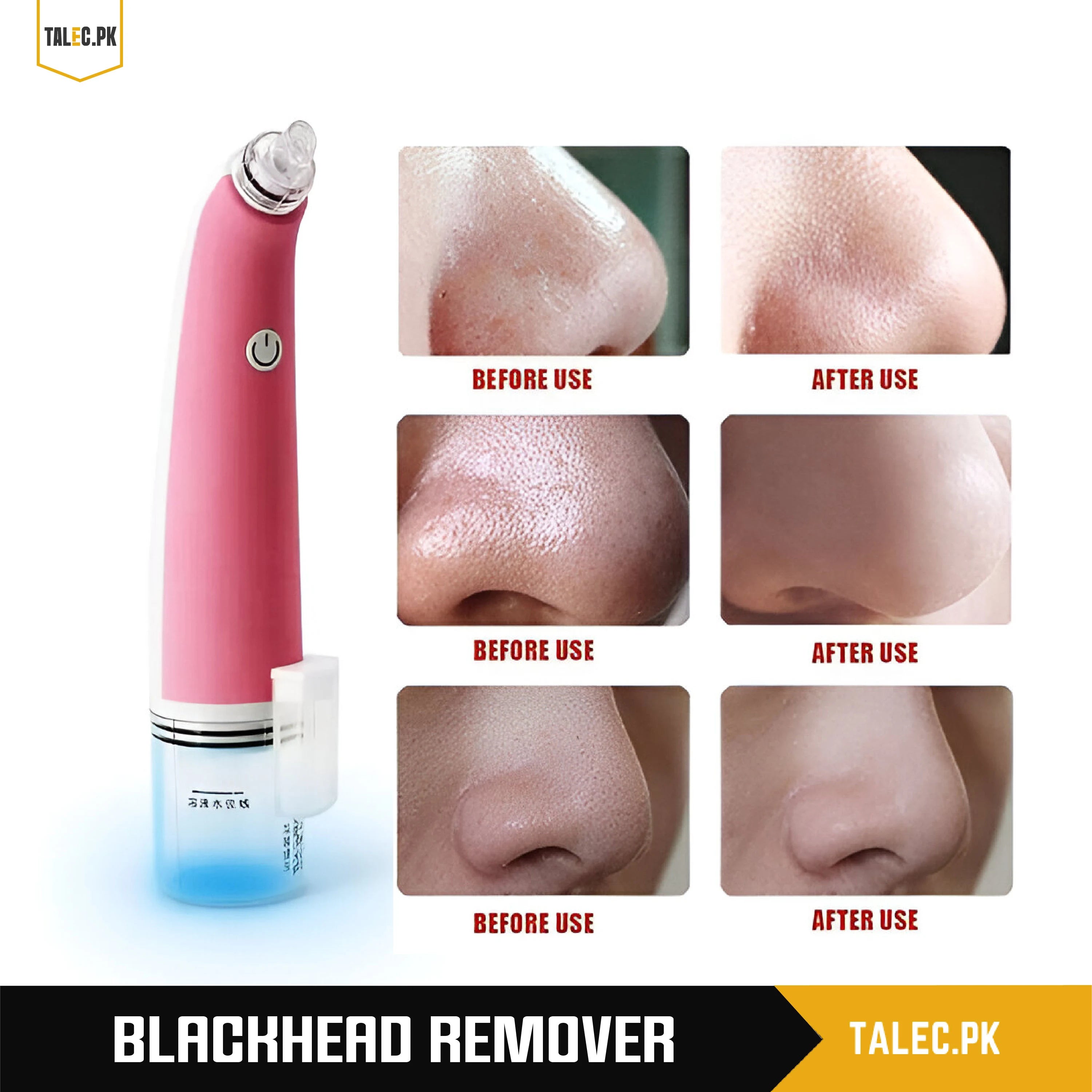 Black Head Remover